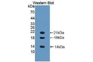 Detection of Recombinant LYAR, Mouse using Polyclonal Antibody to Ly1 Antibody Reactive Homolog (LYAR)