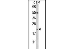 Western blot analysis of NANOS2 Antibody (C-term) (ABIN389197 and ABIN2839360) in CEM cell line lysates (35 μg/lane). (NANOS2 anticorps  (C-Term))