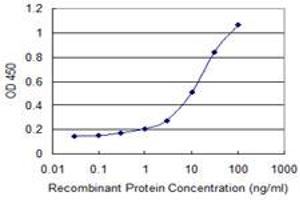 ELISA image for anti-2,4-Dienoyl CoA Reductase 1, Mitochondrial (DECR1) (AA 236-336) antibody (ABIN599370) (DECR1 anticorps  (AA 236-336))