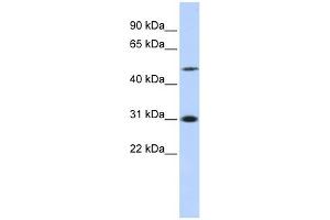 ING3 antibody used at 1 ug/ml to detect target protein. (ING3 anticorps  (N-Term))
