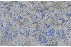 ABIN6272366 at 1/100 staining Human lymph node tissue by IHC-P. (NOX3 anticorps  (Internal Region))