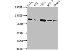 Western Blot Positive WB detected in: Hela whole cell lysate, U87 whole cell lysate, U251 whole cell lysate, MCF-7 whole cell lysate, Rat heart tissue All lanes: ANO2 antibody at 3. (Anoctamin 2 anticorps  (AA 1-83))