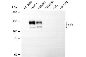 Western blotting analysis using c-kit antibody (ABIN7799335). (Recombinant KIT anticorps)