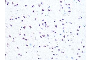 Immunohistochemistry of paraffin-embedded rat brain using HMG Rabbit mAb (ABIN7267646) at dilution of 1:100 (40x lens).
