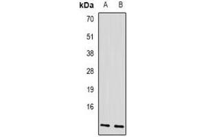 Western blot analysis of AP3-beta-1 expression in SKOV3 (A), mouse liver (B) whole cell lysates. (AP3B1 anticorps)
