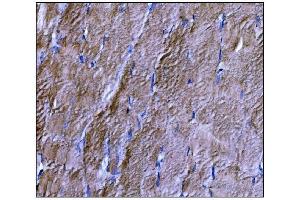 IHC analysis of Dysferlin/DYSF using anti-Dysferlin/DYSF antibody (ABIN7601939).
