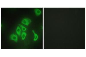 Immunofluorescence analysis of HepG2 cells, using TNF alpha antibody. (TNF alpha anticorps  (Internal Region))