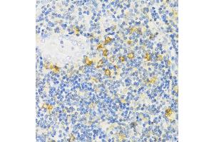 Immunohistochemistry of paraffin-embedded human tonsil using MLKL antibody (ABIN6134395, ABIN6143882, ABIN6143886 and ABIN6217454) at dilution of 1:100 (40x lens). (MLKL anticorps  (C-Term))