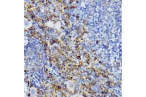 Immunohistochemistry of paraffin-embedded mouse spleen using CD152/CTLA-4 antibody (ABIN3022827, ABIN3022828, ABIN3022829 and ABIN6219247) at dilution of 1:250 (40x lens).