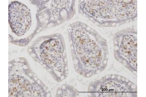 Immunoperoxidase of monoclonal antibody to ASAH1 on formalin-fixed paraffin-embedded human small Intestine.