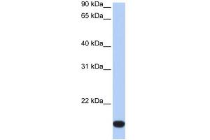 WB Suggested Anti-FLJ44894 Antibody Titration:  0. (FLJ44894 anticorps  (Middle Region))