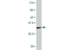 Western Blot detection against Immunogen (38.