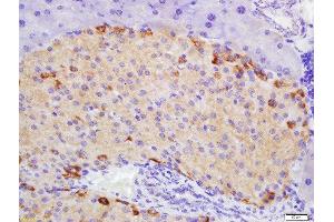 Formalin-fixed and paraffin embedded mouse pancreas labeled with Rabbit Anti-ATG1/ULK1 Polyclonal Antibody, Unconjugated 1:200 followed by conjugation to the secondary antibody and DAB staining (ULK1 anticorps  (AA 951-1050))