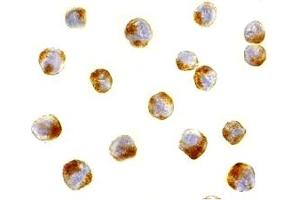 Immunohistochemistry (IHC) image for anti-Activating Transcription Factor 6 (ATF6) (C-Term) antibody (ABIN1030261) (ATF6 anticorps  (C-Term))