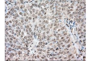 Immunohistochemical staining of paraffin-embedded Human colon tissue using anti-ACAT2 mouse monoclonal antibody. (ACAT2 anticorps)