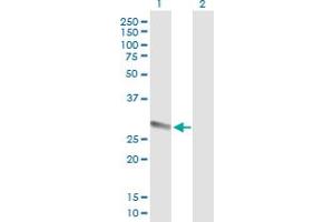 Western Blot analysis of PRSS1 expression in transfected 293T cell line by PRSS1 MaxPab polyclonal antibody. (PRSS1 anticorps  (AA 1-247))