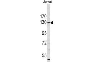 Western Blotting (WB) image for anti-Myosin IA (MYO1A) antibody (ABIN3003156) (Myosin IA anticorps)