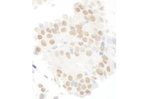 Immunohistochemistry (IHC) image for anti-Microtubule Associated serine/threonine Kinase-Like (MASTL) (AA 550-600) antibody (ABIN7448641)