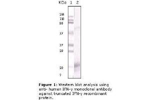 Image no. 1 for anti-Interferon gamma (IFNG) antibody (ABIN207597) (Interferon gamma anticorps)