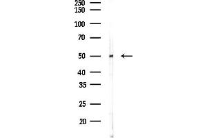 anti-DKK3 antibody