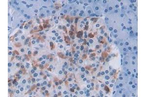 Detection of TFR2 in Human Pancreas Tissue using Polyclonal Antibody to Transferrin Receptor 2 (TFR2)
