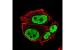 Immunofluorescent staining of human cell line PC-3 with RARG polyclonal antibody  at 1-4 ug/mL concentration shows positivity in nucleus but excluded from the nucleoli.