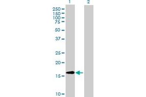 Western Blot analysis of CLUHP3 expression in transfected 293T cell line ( H00079014-T02 ) by CLUHP3 MaxPab polyclonal antibody. (CLUHP3 anticorps  (AA 1-147))