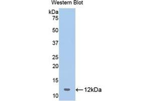 Western blot analysis of the recombinant protein. (OAS1 anticorps  (AA 74-165))