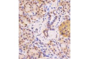(ABIN390462 and ABIN2840832) staining VHL in human pancreas tissue sections by Immunohistochemistry (IHC-P - paraformaldehyde-fixed, paraffin-embedded sections).