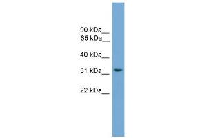WB Suggested Anti-CCDC117 Antibody Titration: 0. (CCDC117 anticorps  (Middle Region))