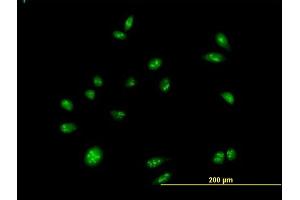 Immunofluorescence of purified MaxPab antibody to CEBPZ on HeLa cell. (CEBPZ anticorps  (AA 1-1054))
