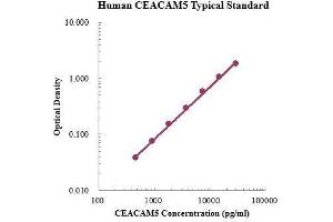 ELISA image for Carcinoembryonic Antigen-Related Cell Adhesion Molecule 5 (CEACAM5) ELISA Kit (ABIN3199206)