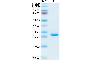 Mouse C-Reactive Protein/CRP on Tris-Bis PAGE under reduced condition.