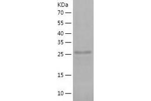 Western Blotting (WB) image for Phosphatidylinositol Transfer Protein, Membrane-Associated 2 (PITPNM2) (AA 162-435) protein (His-IF2DI Tag) (ABIN7124404)