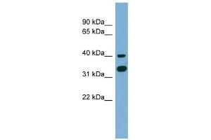 GPN2 antibody used at 1 ug/ml to detect target protein. (GPN2 anticorps  (Middle Region))
