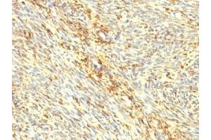 Formalin-fixed, paraffin-embedded human uterus stained with Transglutaminase 2 antibody.