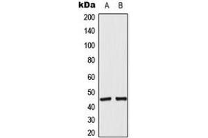 Western blot analysis of ACOT4 expression in RT4 (A), A549 (B) whole cell lysates. (ACOT4 anticorps  (C-Term))