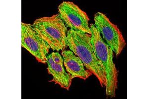 Immunofluorescence analysis of HepG2 cells using CCL2 mouse mAb (green). (CCL2 anticorps)
