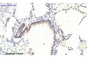 Immunohistochemical analysis of paraffin-embedded rat lung tissue. (ERK1/2 anticorps  (pThr202))