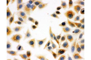 Anti-DCI antibody, ICC ICC: HELA Cell
