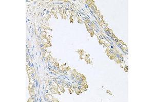 Immunohistochemistry of paraffin-embedded human prostate using PPP3R1 antibody at dilution of 1:100 (x40 lens). (PPP3R1 anticorps)