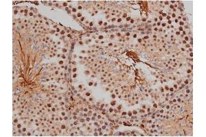 ABIN6267333 at 1/200 staining Mouse testis tissue sections by IHC-P. (SP1 anticorps  (pThr453))