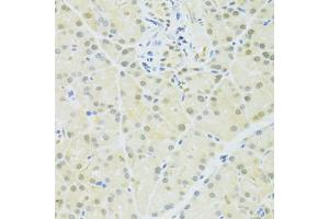 Immunohistochemistry of paraffin-embedded rat pancreas using BRCA1 antibody (ABIN6291827) at dilution of 1:100 (40x lens). (BRCA1 anticorps)