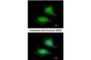 ICC/IF Image Immunofluorescence analysis of methanol-fixed HeLa, using LZTFL1, antibody at 1:200 dilution.