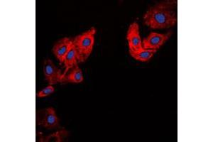 Immunofluorescent analysis of Collagen 5 alpha 1 staining in HeLa cells. (COL5A1 anticorps  (Center))