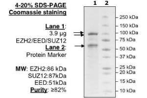 Western Blotting (WB) image for Enhancer of Zeste Homolog 2 (EZH2) (Lys27) (Active) protein (DYKDDDDK Tag,His tag) (ABIN2669606) (EZH2 Protein (Lys27) (DYKDDDDK Tag,His tag))