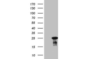 Western Blotting (WB) image for anti-ATP-Binding Cassette, Sub-Family C (CFTR/MRP), Member 5 (ABCC5) antibody (ABIN2715615) (ABCC5 anticorps)
