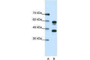WB Suggested Anti-PSMC5 Antibody Titration:  1.