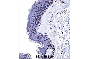 CSRP2 Antibody (Center) ((ABIN657989 and ABIN2846936))immunohistochemistry analysis in formalin fixed and paraffin embedded human skin tissue followed by peroxidase conjugation of the secondary antibody and DAB staining. (CSRP2 anticorps  (AA 68-96))