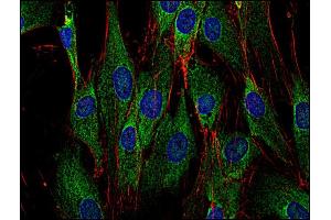 Immunocytochemistry staining of Sos in human primary fibroblasts using anti-Sos (SOS-01, green). (Sos anticorps)